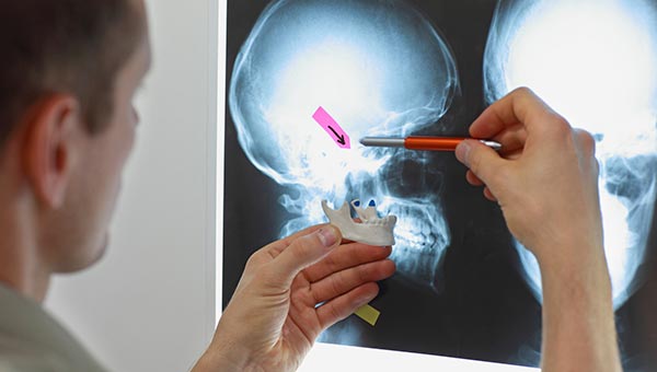 Doctor examining xray with model of the jaw