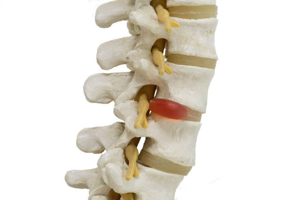 lumbar spine model